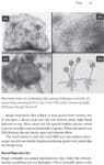 Close-ups of black bread mold showing fuzzy surface, stems with black spheres, and spore details.